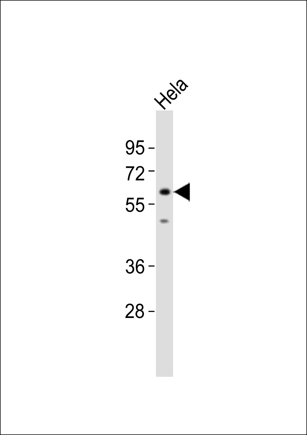 Anti-SRSF4 Antibody at 1:1000 dilution + HeLa whole cell lysates Lysates/proteins at 20 µg per lane. Secondary Goat Anti-Rabbit IgG, (H+L),Peroxidase conjugated at 1/10000 dilution Predicted band size : 57 kDa Blocking/Dilution buffer: 5% NFDM/TBST.