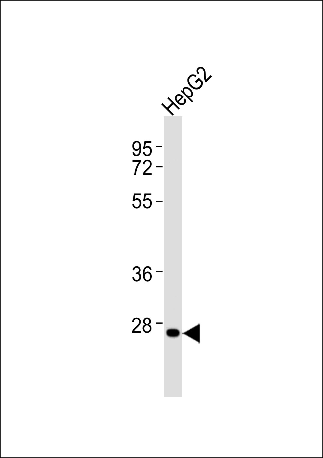 Anti-HOXC12 Antibody at 1:1000 dilution + HepG2 whole cell lysates Lysates/proteins at 20 µg per lane. Secondary Goat Anti-Rabbit IgG, (H+L),Peroxidase conjugated at 1/10000 dilution Predicted band size : 30 kDa Blocking/Dilution buffer: 5% NFDM/TBST.