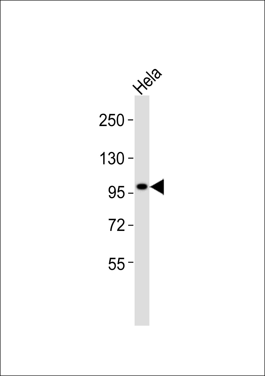 Anti-Kv10.1 Antibody at 1:1000 dilution + HeLa whole cell lysates Lysates/proteins at 20 µg per lane. Secondary Goat Anti-Rabbit IgG, (H+L),Peroxidase conjugated at 1/10000 dilution Predicted band size : 111 kDa Blocking/Dilution buffer: 5% NFDM/TBST.