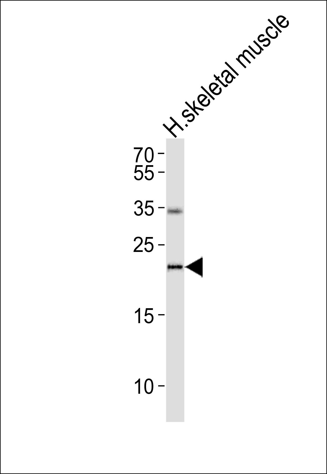 Western blot analysis of lysate from human skeletal muscle tissue lysate,using IFNW1 Antibody was diluted at 1:1000. A goat anti-rabbit IgG H&L(HRP) at 1:5000 dilution was used as the secondary antibody.Lysate at 35ug.