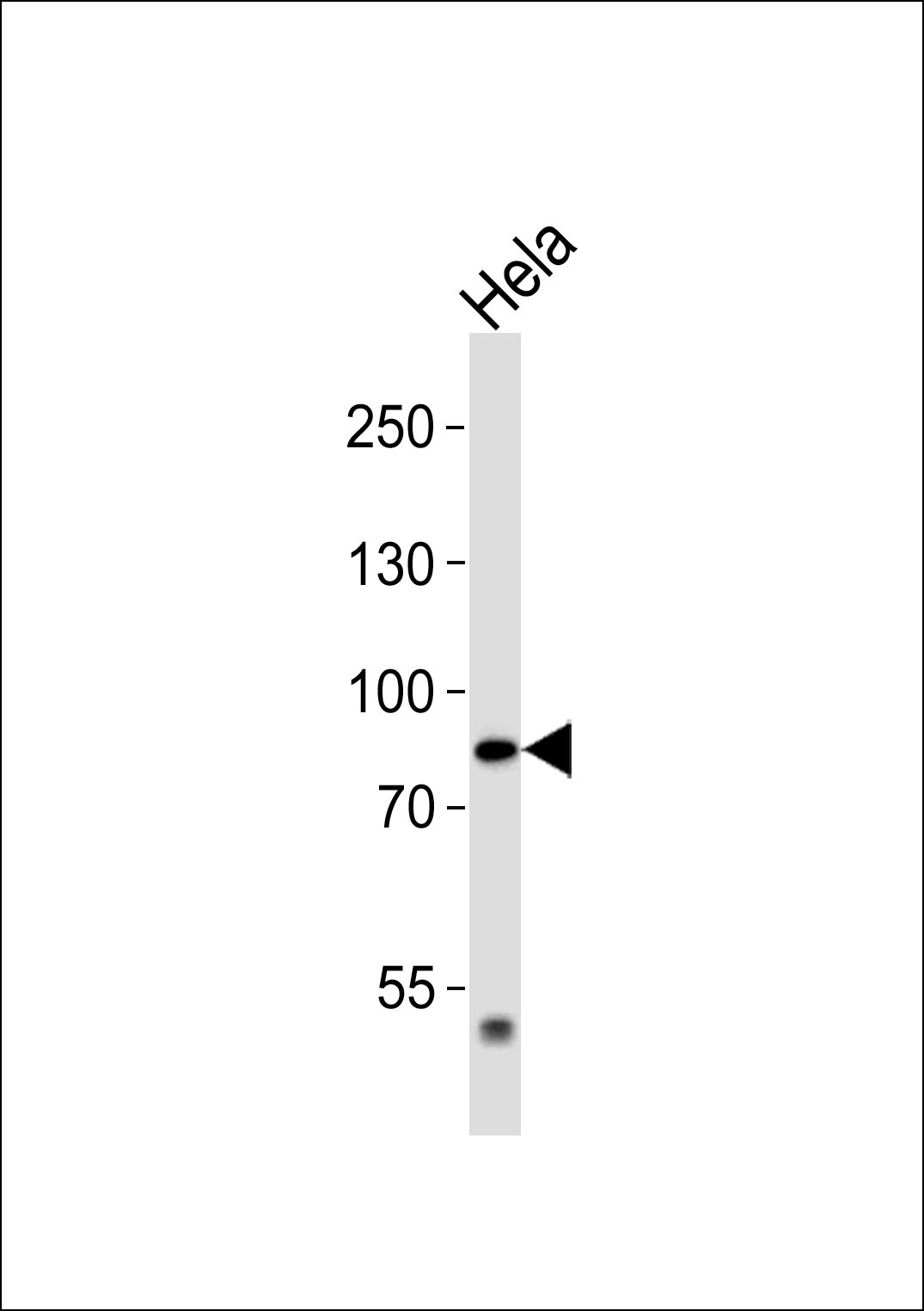 Western blot analysis of lysate from Hela cell line,using LZTR1 Antibody was diluted at 1:1000. A goat anti-rabbit IgG H&L(HRP) at 1:5000 dilution was used as the secondary antibody.Lysate at 35ug.
