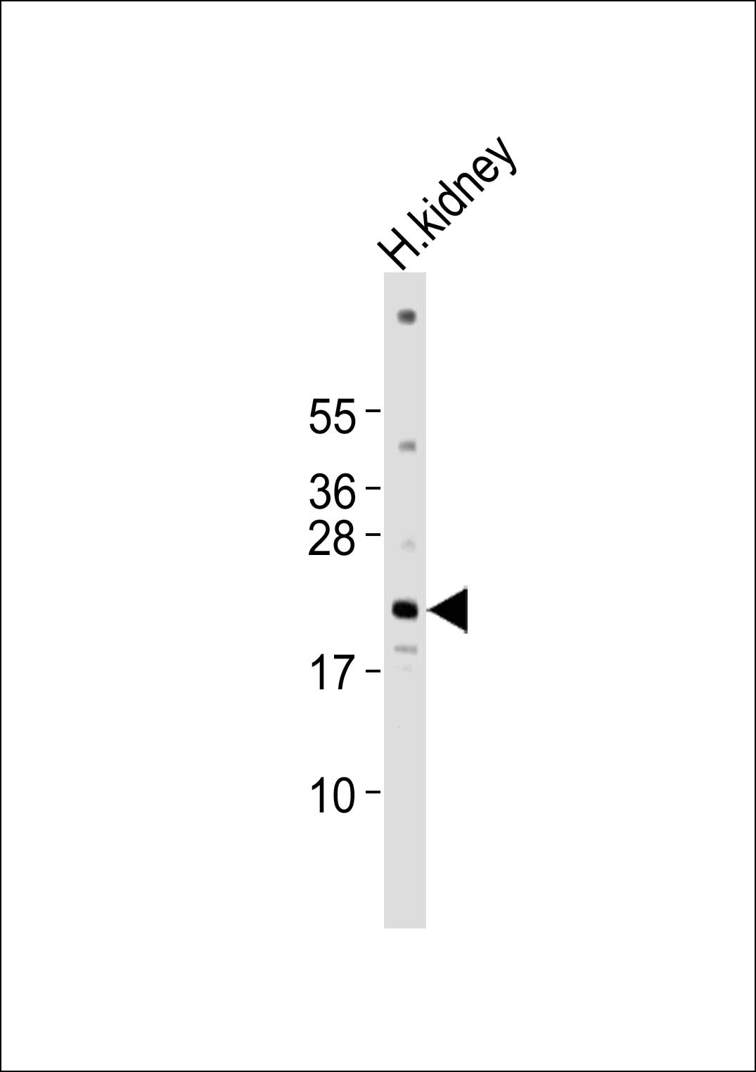 Anti-PPP1R14D Antibody at 1:1000 dilution + human kidney lysates Lysates/proteins at 20 µg per lane. Secondary Goat Anti-Rabbit IgG, (H+L),Peroxidase conjugated at 1/10000 dilution Predicted band size : 17 kDa Blocking/Dilution buffer: 5% NFDM/TBST.