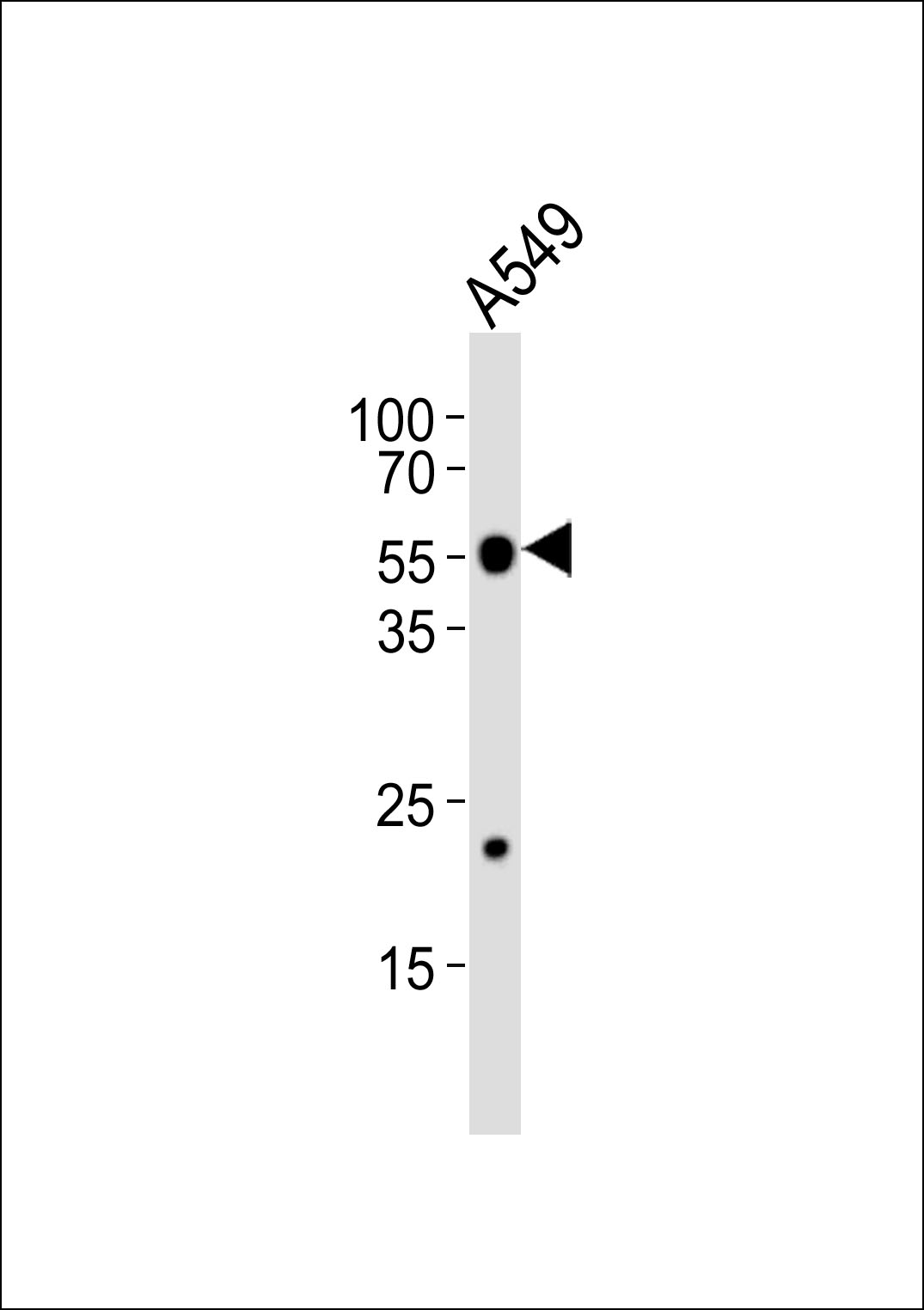 Western blot analysis of lysate from A549 cell line,using LPCAT2 Antibody(AP50790). AP50790 was diluted at 1:1000. A goat anti-rabbit IgG H&L(HRP) at 1:5000 dilution was used as the secondary antibody.Lysate at 35ug.