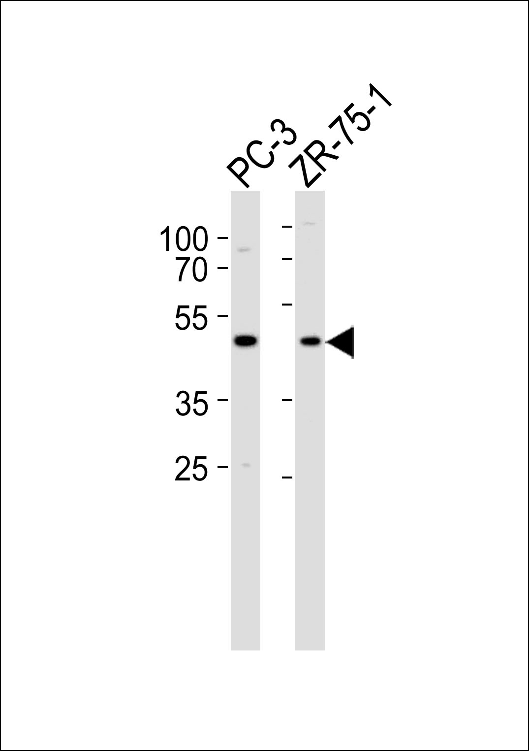 Western blot analysis of lysates from PC-3,ZR-75-1 cell line (from left to right),using VN1R5 Antibody(AP50793). AP50793 was diluted at 1:1000 at each lane. A goat anti-rabbit IgG H&L(HRP) at 1:5000 dilution was used as the secondary antibody.Lysates at 35ug per lane.