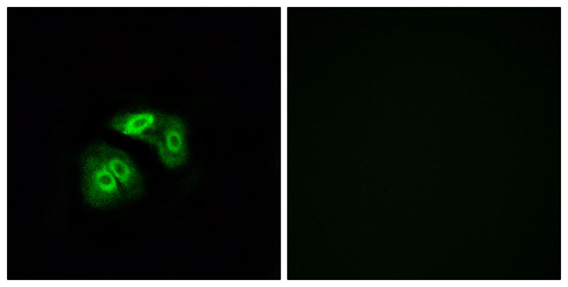 Immunofluorescence analysis of A549 cells, using VN1R5 antibody.