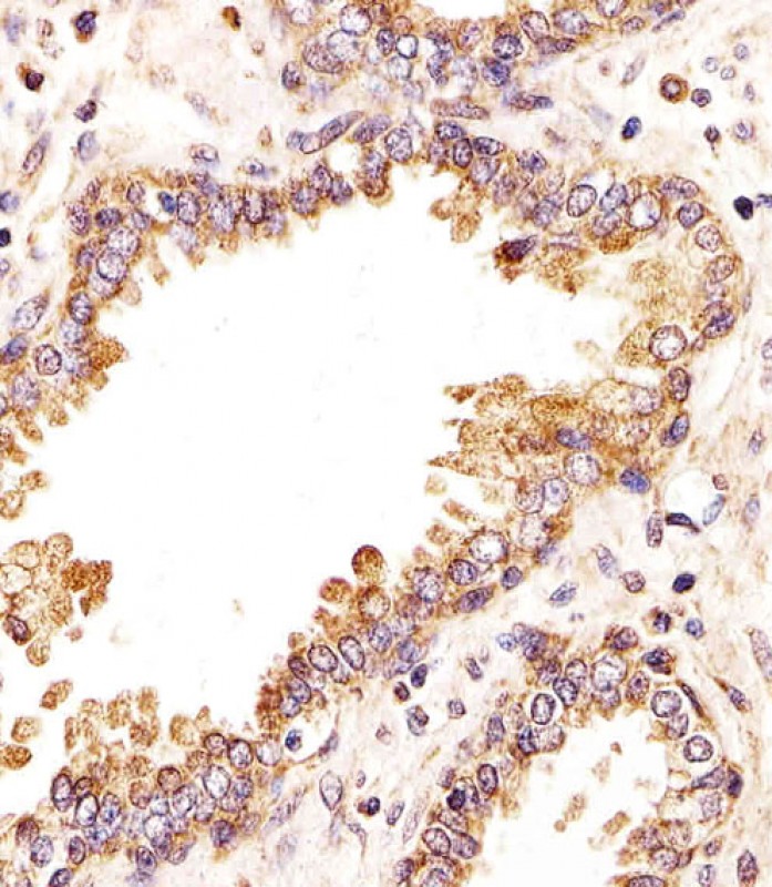 Immunohistochemical analysis of paraffin-embedded H. prostate section using ZRSR2 Antibody (C-term)(Cat#AP20436b). AP20436b was diluted at 1:25 dilution. A undiluted biotinylated goat polyvalent antibody was used as the secondary, followed by DAB staining.