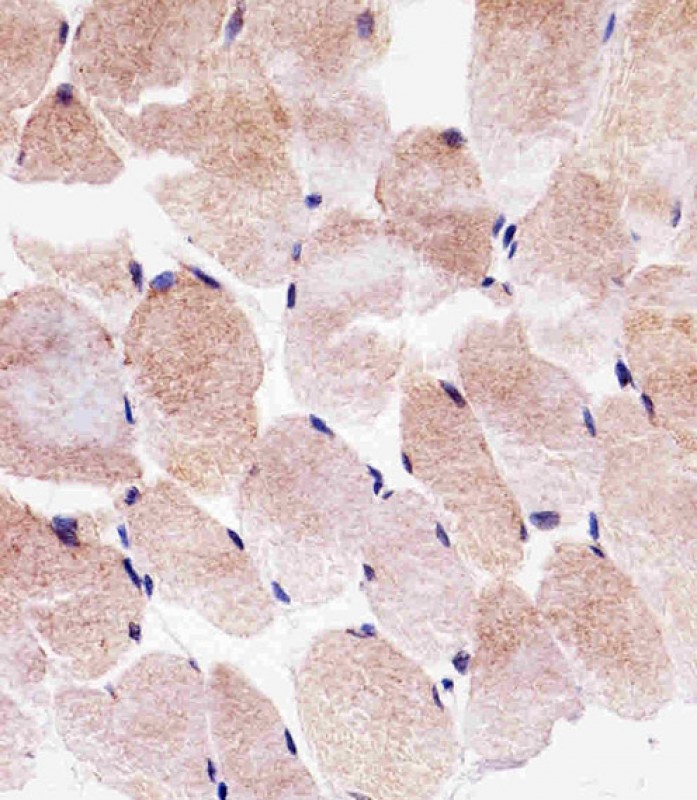 Immunohistochemical analysis of paraffin-embedded H. skeletal muscle section using SLC25A25 Antibody (N-term)(Cat#AP20508A). AP20508A was diluted at 1:25 dilution. A undiluted biotinylated goat polyvalent antibody was used as the secondary, followed by DAB staining.