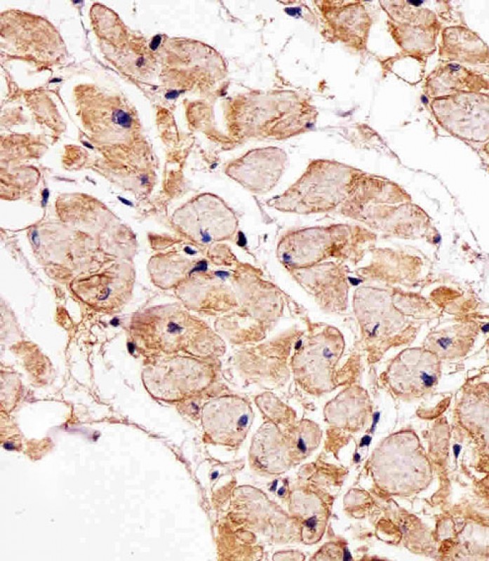 Immunohistochemical analysis of paraffin-embedded H. heart section using SSPN Antibody (N-term)(Cat#AP20496A). AP20496A was diluted at 1:25 dilution. A undiluted biotinylated goat polyvalent antibody was used as the secondary, followed by DAB staining.