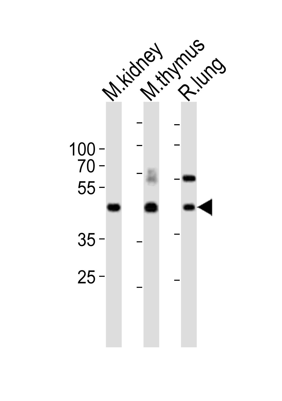 Western blot analysis of lysates from mouse kidney, mouse thymus, rat lung tissue lysate (from left to right), using Dlk1 Antibody (C-term)(Cat. #AP20860c). AP20860c was diluted at 1:1000 at each lane. A goat anti-rabbit IgG H&L(HRP) at 1:10000 dilution was used as the secondary antibody. Lysates at 20ug per lane.