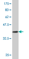 Antibody Reactive Against Recombinant Protein.Western Blot detection against Immunogen (37.73 KDa) . 