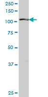 RIN2 monoclonal antibody (M04), clone 1E6. Western Blot analysis of RIN2 expression in Y-79 ( (Cat # AT3643a )