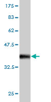 Antibody Reactive Against Recombinant Protein.Western Blot detection against Immunogen (37.73 KDa) . 