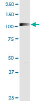 RIN2 monoclonal antibody (M01), clone 1E7. Western Blot analysis of RIN2 expression in human liver.