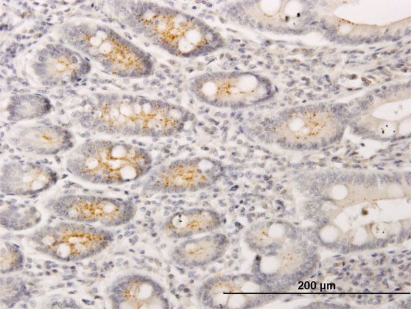 Immunoperoxidase of monoclonal antibody to RIN2 on formalin-fixed paraffin-embedded human small Intestine. [antibody concentration 1.5 ug/ml]