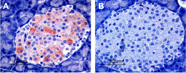 Expression of Kir6.2 in rat pancreas Immunohistochemical staining of rat pancreas using Anti-Kir6.2 antibody (#AG1143). A. Strong granular staining in a number of cells within the Islets of Langerhans is readily detected (red). B. The negative control slide shows no staining.