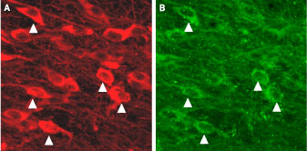 Expression of KCa2.3 in mouse dopaminergic neurons Immunohistochemical staining of mouse dopaminergic neurons using Anti-KCa2.3 (SK3) (N-term) antibody (#AG1139). A. KCa2.3 is detected in substantia nigra pars compacta. B. Tyrosine hydroxylase staining shows dopaminergic neurons. Triangles point at cells with co-localization.