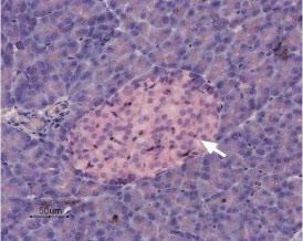 Expression of K2P5.1 in rat pancreas Immunohistochemical staining of rat pancreas was visualized using Anti-K2P5.1 (TASK-2) antibody (#AG1132), (1:50). Paraffin embedded sections of rat pancreas showing both endocrine (Islets of Langerhans) and exocrine areas. Strong and highly specific staining is evident only in endocrine cells (arrow). Universal Immuno-alkaline-phosphatase Polymer followed by New Fuchsin Substrate (Histofine, Nichirei Corp.) was used for the color reaction. Hematoxilin is used as the counterstain.