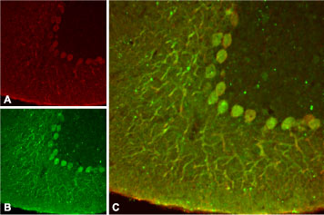 Expression of K2P4.1 in rat cerebellum Immunohistochemical staining of rat cerebellum using Anti- K2P4.1 (TRRAK) antibody (#AG1103 ). A. K2P4.1 channel appears in Purkinje neuronal processes (red). B. Staining of Purkinje nerve cells with mouse anti-calbindin D28K (a calcium binding protein, green). C. Confocal merge of K2P4.1 channel and calbindin D28K demonstrates the co-localization of these proteins.