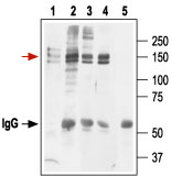 Immunoprecipitation of Kv11.1 expressing HEK-293 cells: Cell lysate. Lysate + protein A beads + Anti-Kv11.1 (HERG) (extracellular) antibody (#AG1102). Lysate + protein A beads + Anti-Kv11.1 (erg1) antibody (#APC-016). Lysate + protein A beads + Anti-hKv11.1 (HERG) antibody (#APC-062). Lysate + protein A beads + pre-immune rabbit serum. Red arrow indicates Kv11.1 while the black arrow shows the IgG heavy chain. Immunoblot was performed with Anti-Kv11.1 (HERG) (extracellular) antibody.