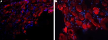 Expression of P2X3 Receptor in rat DRG Immunohistochemical staining of rat dorsal root ganglion (DRG) frozen sections using Anti-P2X3 Receptor (extracellular) antibody (#AG1060), followed by anti-rabbit-AlexaFluor-594 secondary antibody. P2X3 Receptor staining (red) appears in neuronal cell bodies. DAPI was used as the counter stain (blue). A. X20 magnification. B. X40 magnification.