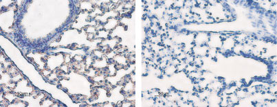 Expression of Aquaporin 5 in rat lung Immunohistochemical staining of rat lung sections using Anti-Aquaporin 5  antibody (#AG1045), (left panel). The strong staining in the alveoli (red brown) is consistent with type 1 pneumocytes (arrows). Counterstain of cell nuclei appears blue.  A negative control is shown in the right panel.