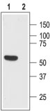 Western blot analysis of rat brain lysate: 1. Anti-Somatostatin Receptor Type 1 (extracellular) antibody (#AG1021), (1:200). 2. Anti-Somatostatin Receptor Type 1 (extracellular) antibody, preincubated with the control peptide antigen.