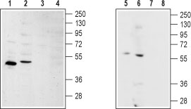Western blot analysis of rat kidney (lanes 1 and 3) and rat heart (lanes 2 and 4) lysates: 1, 2. Anti-Sphingosine 1-Phosphate Receptor 2 antibody (#AG1014), (1:200). 3, 4. Anti-Sphingosine 1-Phosphate Receptor 2 antibody, preincubated with the control peptide antigen.
