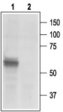 Western blot analysis of rat DRG lysates: 1. Anti-P2X3 Receptor antibody (AG1399), (1:200). 2. Anti-P2X3 Receptor antibody, preincubated with the control peptide antigen.
