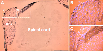 Expression of P2X3 Receptor in rat DRG neurons Immunohistochemical staining of rat dorsal root ganglion (DRG) neurons with Anti-P2X3 Receptor antibody (#AG1399), (A). Cells within the DRG were stained (see solid line frame enlarged (B) as well as fibers and the area of entry of dorsal root into spinal cord (see dashed line frame enlarged (C). DAPI is used as the counterstain (in B and C).