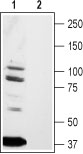 Western blot analysis of rat brain lysates: 1. Anti-TRPV4 antibody (#AG1349), (1:200). 2. Anti-TRPV4 antibody, preincubated with the control peptide antigen.