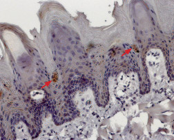 Expression of TRPM5 in rat tongue Immunohistochemical staining of rat tongue paraffin embedded sections using Anti-TRPM5 antibody (#AG1343), (1:100). TRPM5 is expressed in discrete groups of cells deep in the sulcus of the papillae. Hematoxilin is used as the counterstain.