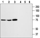 Western blot analysis of RBL (lanes 1 and 4), HL-60 (lanes 2 and 5), and Jurkat (lanes 3 and 6) cell lysates: 1, 2, 3. Anti-STIM1 (extracellular) antibody (#AG1335), (1:1000). 4, 5, 6. Anti-STIM1 (extracellular) antibody, preincubated with the control peptide antigen.