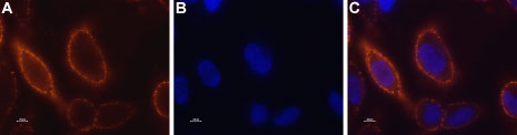 Expression of STIM1 in RBL cells Immunocytochemical staining of STIM1 in live rat basophilic leukemia (RBL) cells. A. Extracellular staining of cells with Anti-STIM1 (extracellular) antibody (#AG1335), (1:50) followed by goat anti-rabbit-AlexaFluor-555 secondary antibody. B. Nuclear staining of cells using the cell-permeable dye Hoechst 33342. C. Merged image of panels A and B.