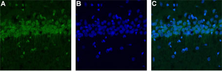 Expression of Calcium Homeostasis Modulator 1 in rat hippocampus Immunohistochemical staining of rat hippocampus using Anti-Calcium Homeostasis Modulator 1 antibody (#AG1327).  A. Staining of Calcium Homeostasis Modulator 1 appears only in the hippocampal CA1 pyramidal layer (red).  B. Nuclear staining using DAPI as the counterstain (blue).  C. Merge of A and B.