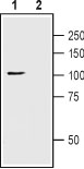 Western blot analysis of rat brain lysate: 1. Anti-TRPC1 (extracellular) antibody (#AG1323), (1:200). 2. Anti-TRPC1 (extracellular) antibody, preincubated with the control peptide antigen.
