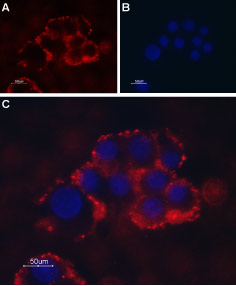 Expression of TRPC1 in PC12 cells Immunocytochemical staining of intact living PC12 cells. A. Extracellular staining of cells with Anti-TRPC1 (extracellular) antibody (#AG1323), (1:50) followed by goat anti-rabbit-AlexaFluor-594 secondary antibody. B. Nuclear staining with DAPI as the counterstain. C. Merged images of A and B.