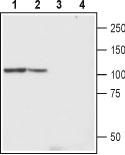 Western blot analysis of rat and mouse brain lysates: 1. Anti-TRPC4 (extracellular) antibody (#AG1322), (1:200). 2. Anti-TRPC4 (extracellular) antibody, preincubated with the control antigen.