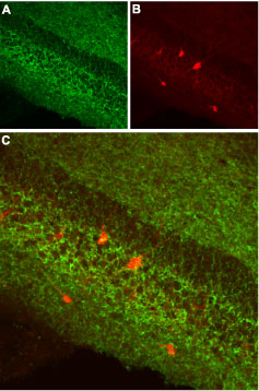 Expression of CB1R in mouse hippocampus Immunohistochemical staining of mouse hippocampus using Anti-Cannabinoid Receptor 1 (extracellular) antibody (#AG1300), (1:100). A. CB1R is detected in pyramidal and infra-pyramidal layers (green). B. Staining of interneurons using mouse anti-parvalbumin (PV) antibody (red). C. Confocal merge of A and B does not indicate the presence of CB1R in GABAergic cells.