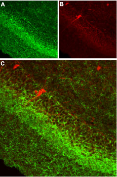 Expression of CB1R in rat hippocampus Immunohistochemical staining of rat hippocampus using Anti-Cannabinoid Receptor 1 (extracellular) antibody (#AG1300) (1:100). A. CB1R is detected in pyramidal and infra-pyramidal layers (green). B. Staining of interneurons using mouse anti-parvalbumin (PV) antibody (red). C. Confocal merge of A and B does not indicate the presence of CB1R in GABAergic cells.