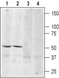 Western blot analysis of mouse brain (lanes 1 and 3) and rat brain (lanes 2 and 4) lysates: 1, 3. Anti-β3-Adrenoceptor (extracellular) antibody (#AG1379), (1:200). 2, 4. Anti-β3-Adrenoceptor (extracellular) antibody, preincubated with the control peptide antigen.
