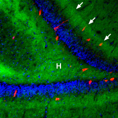 Expression of β3-Adrenoceptor in rat hippocampus Immunohistochemical staining of rat hippocampal dentate gyrus using Anti-β3-Adrenoceptor antibody (#AG1379), (1:100), (green). β3-Adrenoceptor is strongly expressed in the hilus (H) and in the outer molecular layer (arrows). The distribution overlaps the entire layers, but is not restricted to nerve cells (stained red with mouse anti Parvalbumin). DAPI is used as the counterstain (blue).