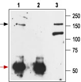 Immunoprecipitation of rat brain lysate: 1. Cell lysate + protein A beads + Anti-mGluR1 (extracellular) antibody (#AG1263). 2. Cell lysate + protein A beads + pre-immune rabbit serum. 3. Cell lysate.