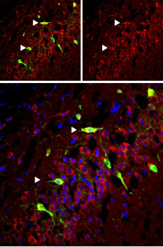 Expression of mGluR5 in rat cerebellum and hippocampus Immunohistochemical staining of perfusion-fixed frozen rat hippocampus sections using Anti-mGluR5 (extracellular) antibody (#AG1262), (1:50). mGluR5 (red) was detected in CA3 cells (arrows). Staining with mouse anti-parvalbumin (green) revealed co-localization in pyramidal layer. DAPI counterstain was used to visualize nuclei of all cells (blue)