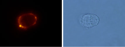 Expression of mGluR5 in rat GH3 pituitary cells Immunocytochemical staining of live intact rat GH3 pituitary cells using Anti-mGluR5 (extracellular) antibody (#AG1262), (1:100), followed by goat-anti-rabbit-AlexaFluor-555 secondary antibody.