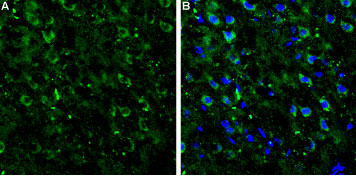 Expression of mGluR7 in rat neocortex Immunohistochemical staining of rat neocortex frozen sections using Anti-mGluR7 (extracellular) antibody (#AG1255). A. mGluR7 staining (green) appears in several neocortical neurons. B. Merge image showing mGluR7 staining together with cell nuclei (blue).