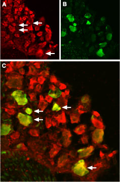 Expression of TRPV1 in rat DRG Immunohistochemical staining of rat dorsal root ganglion (DRG) using Anti-TRPV1 antibody (#AG1452). A. TRPV1 (red) in DRG neurons. B. Staining with mouse anti-Parvalbumin (green) in the same DRG section. C. Confocal merge of TRPV1 and Parvalbumin demonstrates colocalization (arrows).