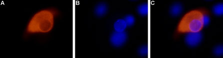 Expression of TRPV1 in rat DRG primary culture Immunocytochemical staining of paraformaldehyde-fixed and permeabilized rat dorsal root ganglia (DRG) primary cells with Anti-TRPV1 antibody (#AG1452), (1:200). A. Staining followed by goat anti-rabbit-AlexaFluor-555 secondary antibody. B. Nuclear staining using the cell-permeable dye Hoechst 33342. C. Merged image of panels A and B.