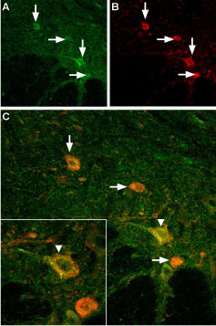Expression of TRPV3 in mouse spinal cord Immunohistochemical staining of mouse spinal cord using Anti-TRPV3 (extracellular) antibody (#AG1451). A. TRPV3 (green) appears in neurons (vertical arrows) in the ventral horn of the mouse spinal cord. B. Motor neurons were stained with goat anti choline-acetyltransferase (red). In some motor neurons (A) TRPV3 was more intense (vertical arrow) whereas in others it was weak (horizontal arrows). C. Merged images of panels A and B. The inset in C magnifies one large motor neuron (vertical arrowhead). Note the punctate pattern of TRPV3 on the surface of the soma.
