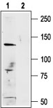 Western blot analysis of A875 (human melanoma cell line) lysate: 1. Anti-Human TRPM1 antibody (#AG1450), (1:200). 2. Anti-Human TRPM1 antibody, preincubated with the control peptide antigen.