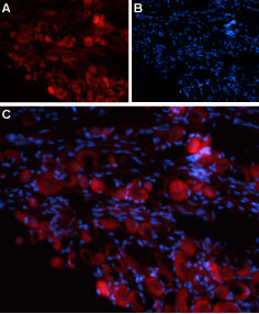 Expression of TRPV4 in rat DRG Immunohistochemical staining of rat dorsal root ganglion (DRG) frozen sections using Anti-TRPV4 (extracellular) antibody (# AG1440). A. TRPV4 labeling appears in neuronal cell bodies. B. Nuclear staining using DAPI as counter stain. C. merged images of A and B.